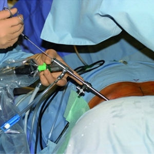 Prós da Cirurgia Endoscópica da Coluna