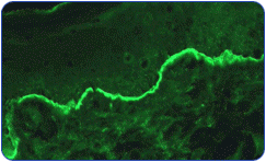 Beutner Labs immunofluorescence animation