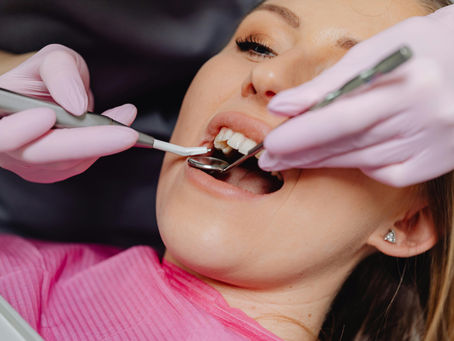 Do I Need a Dental Crown or a Filling?