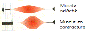 Tendinite épaule coiffe des rotateurs supra épineux