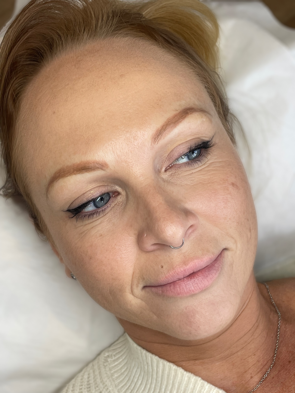 Before combination brows