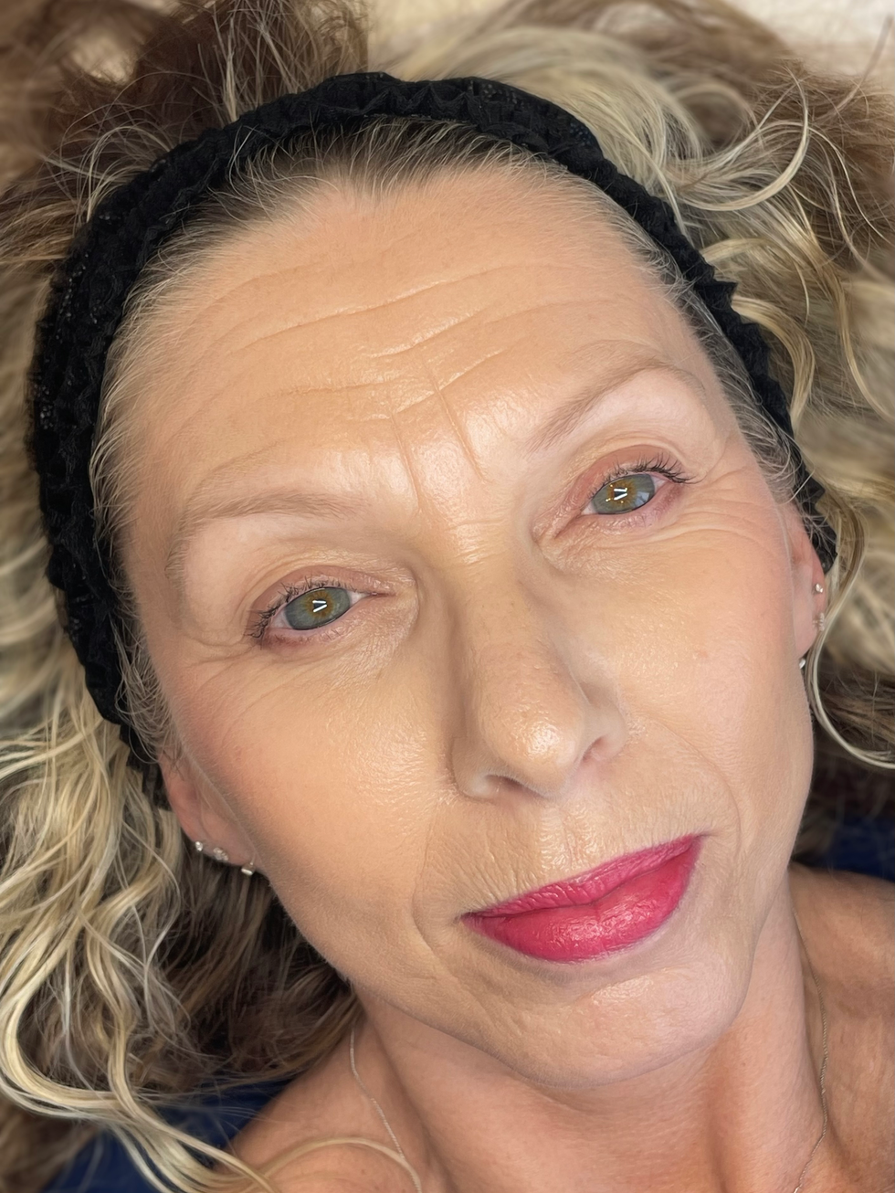 Before image of eyebrows