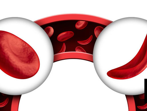 FDA Okays 1st Human Gene Editing Cure For Sickle Cell Disease