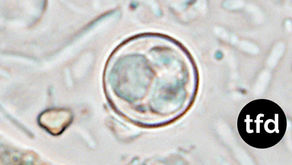 FDA Says Taylor Farms Lettuce Cyclospora Test Was False Positive