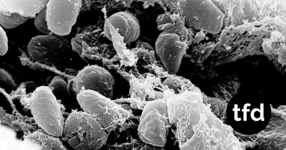 Russia Lab Worker's Death Raises Questions Over Possible Pneumonic Plague