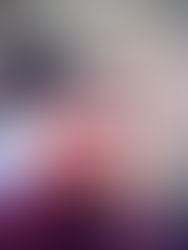 What is Radical inclusion? Why should we welcome it?