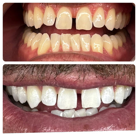 Love Ur Body Transformations