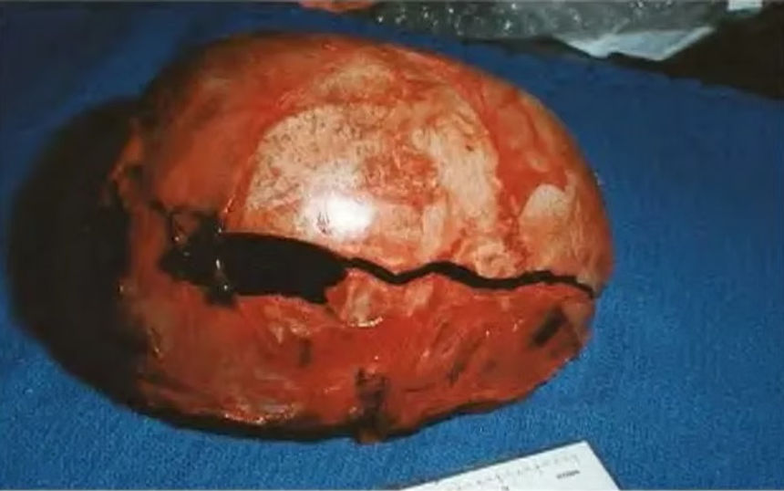 jb skullj.jpg