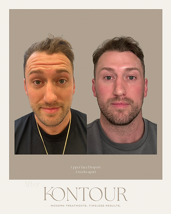 Before.png