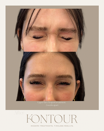 Before.png