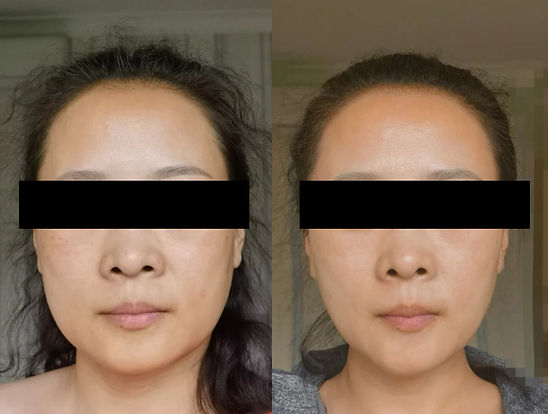 45+姐姐的抗衰路——超S王第30天_1_归蜜_来自小红书网页版.jpg