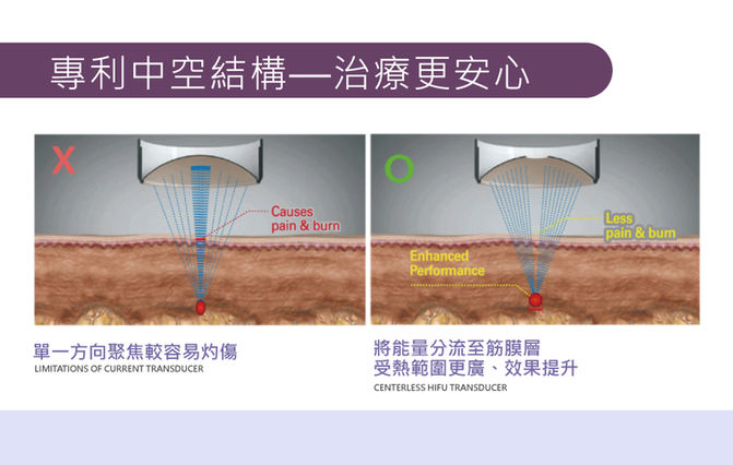 彩蝶戰斧音波8.jpg