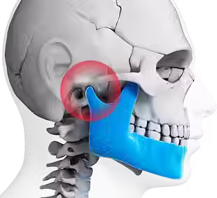 tmj-revised.avif