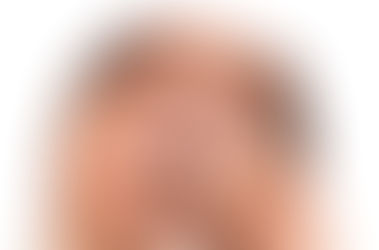 Male Pattern Hair Loss: Genetic Or Heredity?