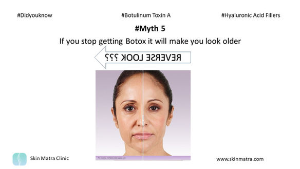 Myth 5: If you stop getting Botox it will make you look older