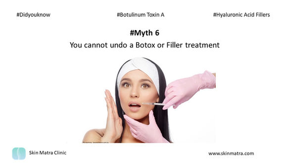 Myth 6: You cannot undo a Botox or Filler Treatment