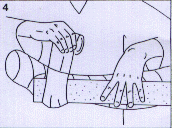 Spider First Aid 4.gif