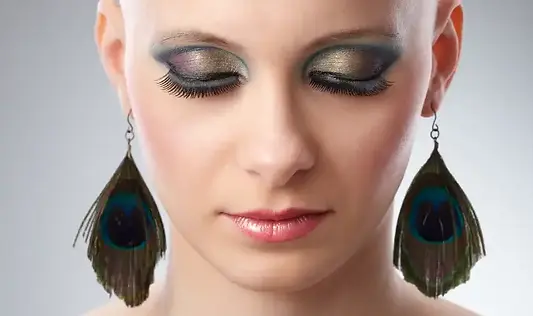 Sukalp Life ™ Hair Company , A Woman with complete hair loss due to chemo therapy .