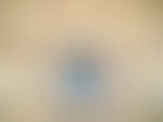 NJ residents are pummeled by hidden health care costs. Fix it, Trenton