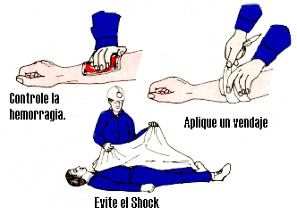 control de hemorragia.gif