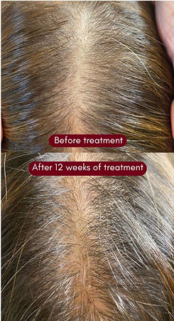 Cellular hair regrowth carousel ad (3)_edited.jpg