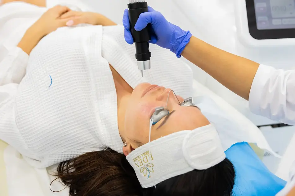 Hyperpigmentation Treatment Procedure in EDEN AESTHETICS Clinic.webp
