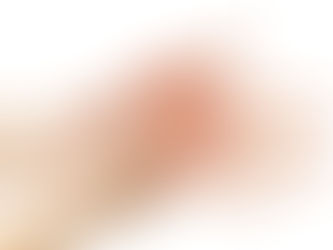 Can Increased BMI Exacerbate Hand Osteoarthritis Pain?