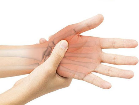 Can Increased BMI Exacerbate Hand Osteoarthritis Pain?