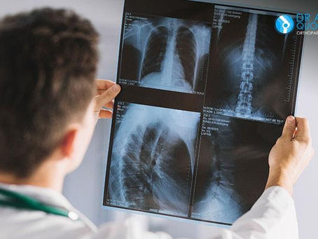 How You Can Approach a Professional Orthopedic Expert