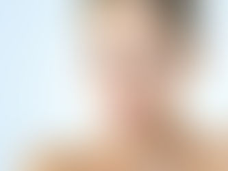 Rejuvenescimento Facial e das Sobrancelhas com menos cicatrizes: Endomidface e EndoBrow