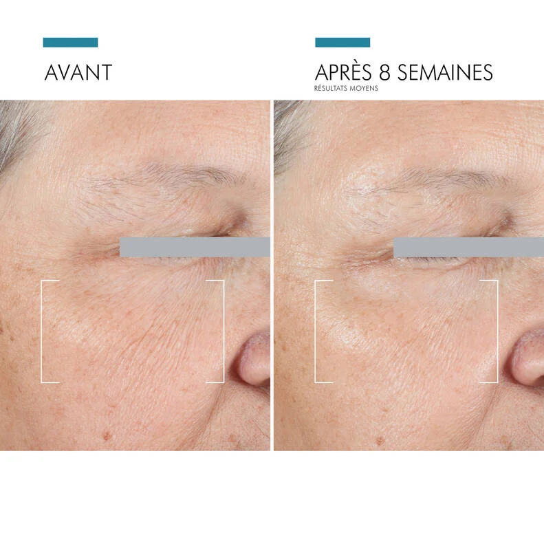 Thumbnail: Skinceuticals - A.G.E. Advanced Eye
