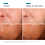 Thumbnail: Skinceuticals - Trio exfoliant et hydratant