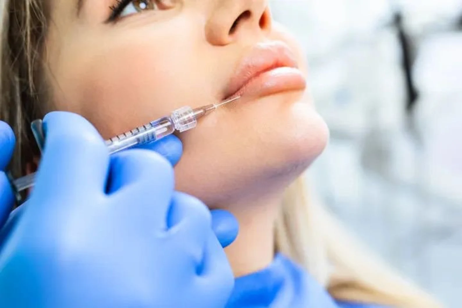FACE FILLER.webp