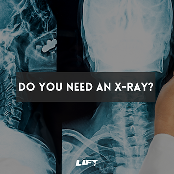 Do You Need An X-Ray.png