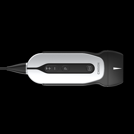 Chison SonoEye P2