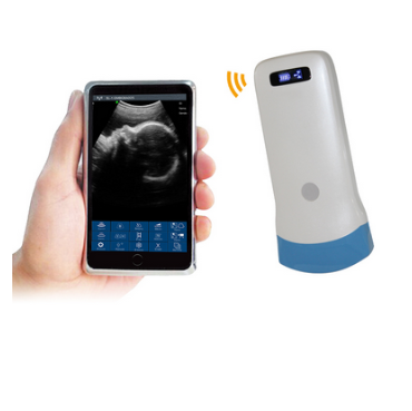 Palm Scanner, wireless, colour doppler, transducer, probe, convex