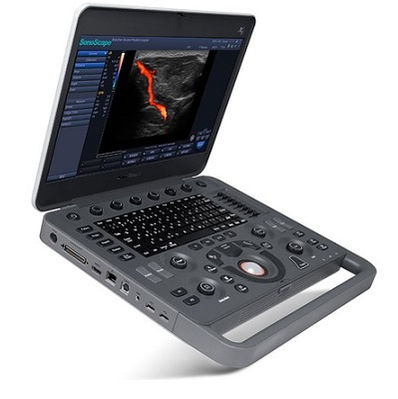 Portable Veterinary Ultrasound Machines