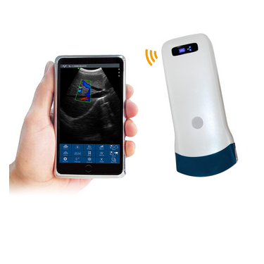 wireless, palm, colour doppler, convex, ultrasound, scanner, ultrasound, transducer, handheld, probe