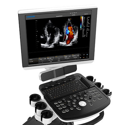 Chison Qbit 7 Portable ultrasound machine