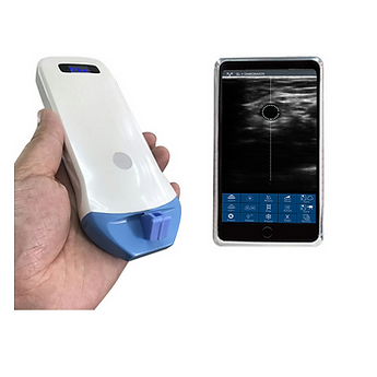 Wireless Ultrasound Probe 5P B&W