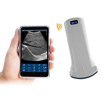 Wireless Ultrasound Probe - 6C Convex