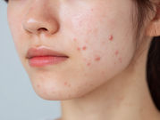 트러블 부위가 잘 진정돼서 만족합니다.