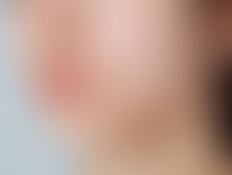 트러블 부위가 잘 진정돼서 만족합니다.