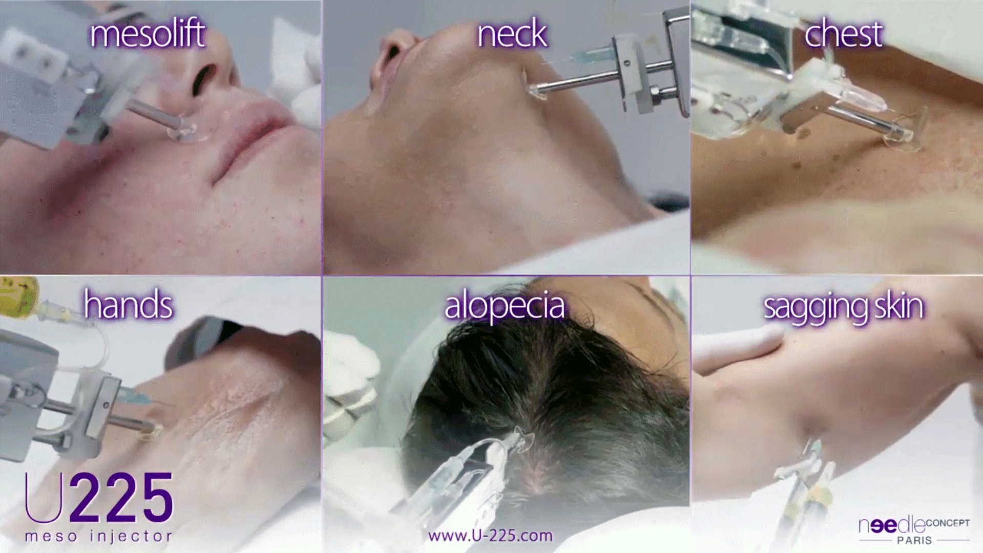 imagens SkinJector U225 2.gif