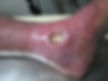 Feridas 5