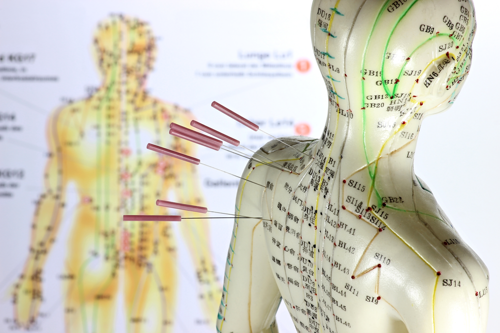 Differences between Acupuncture and Community Style ...