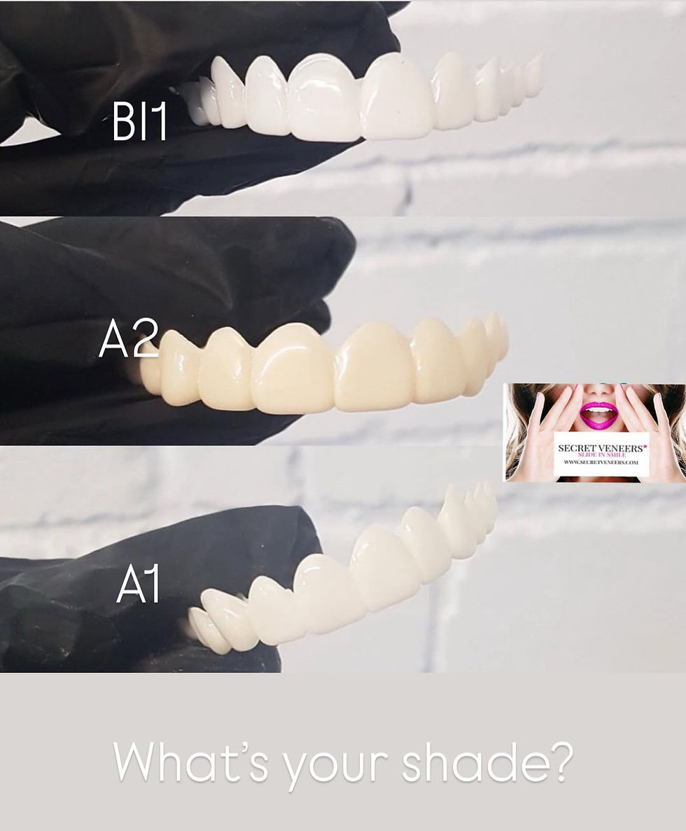 Thumbnail: REPLACEMENTS for customers who have already had secret veneers designed.