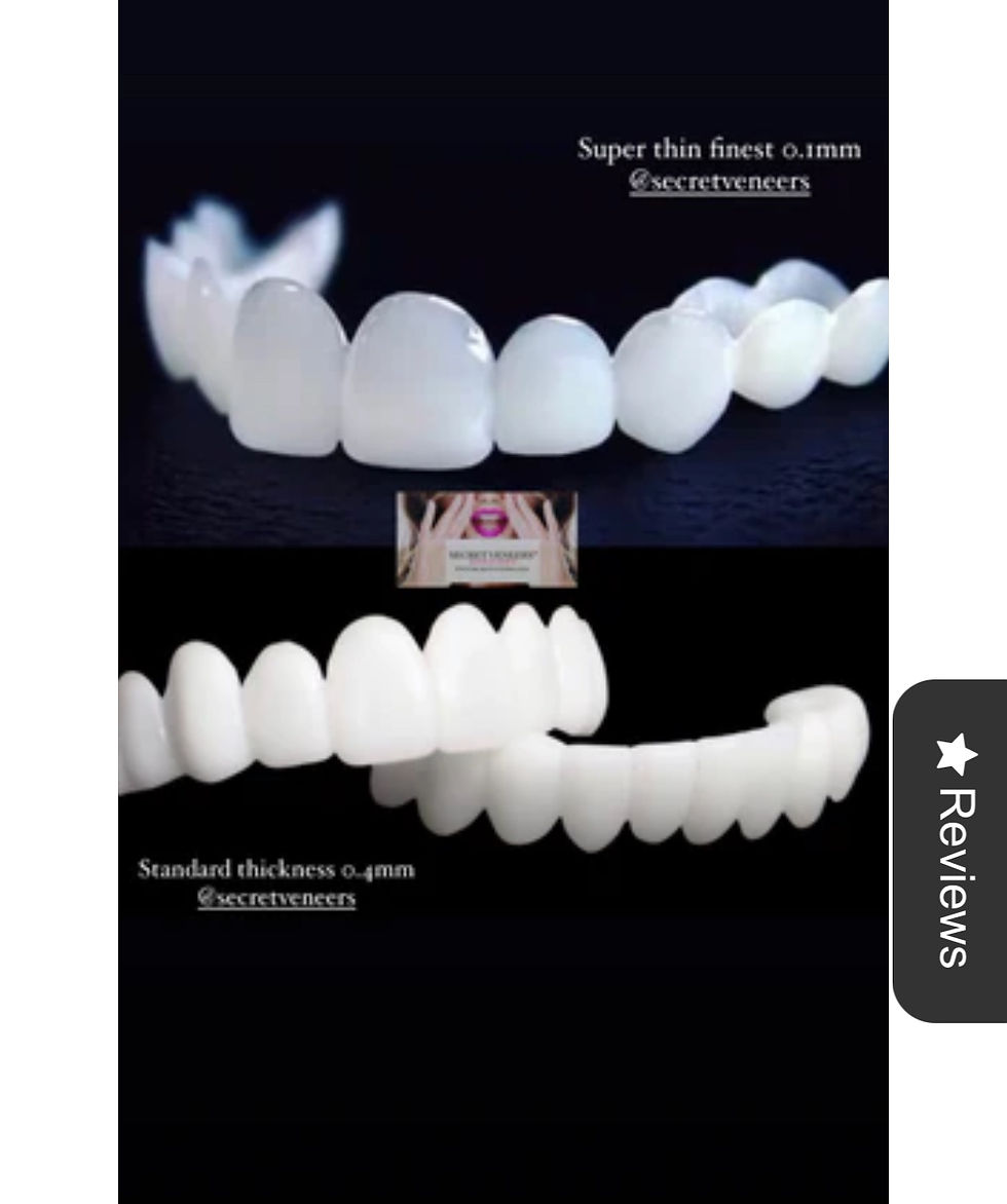 Thumbnail: Just an upper or a lower arch (not a full set)