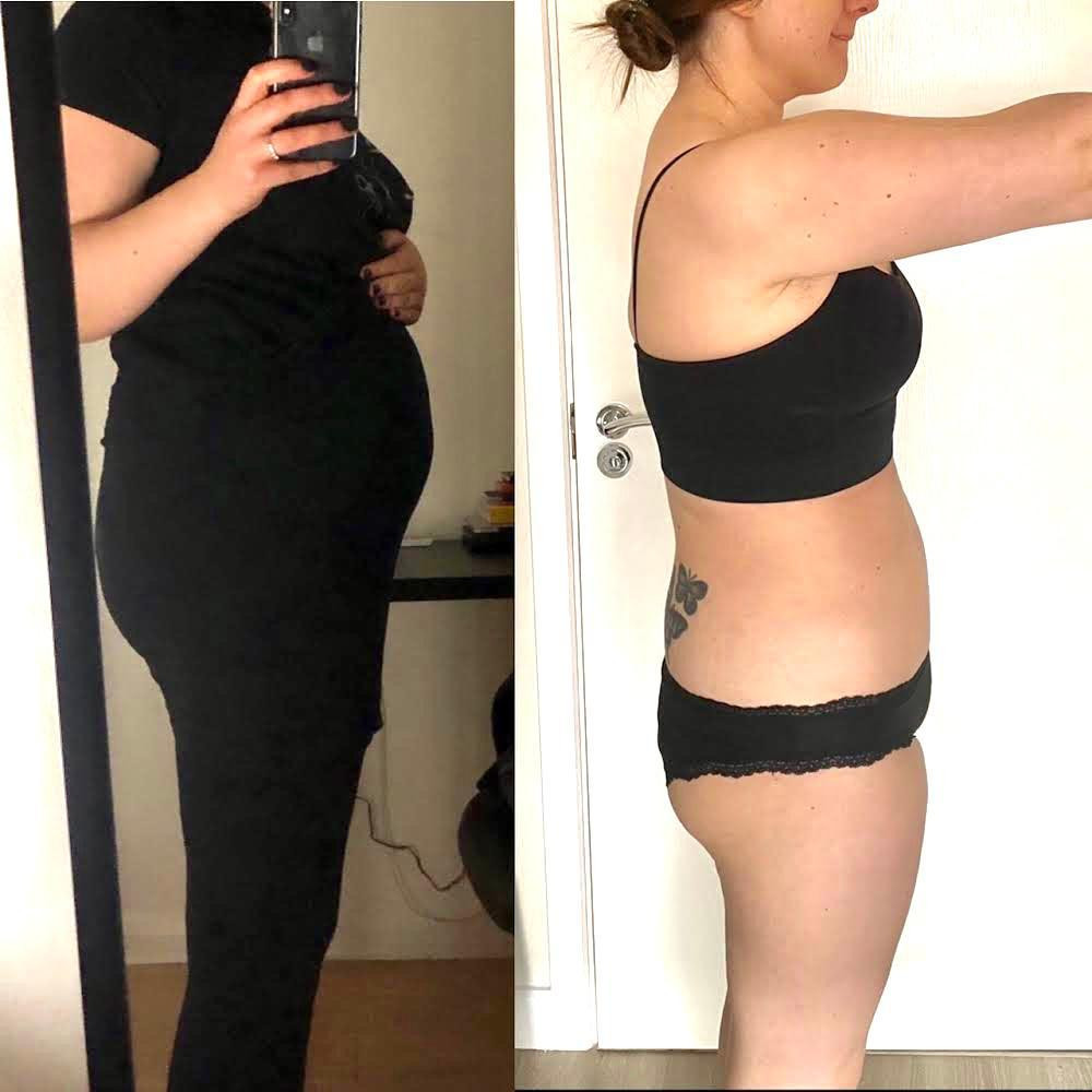 case study bloating fatigue before and after