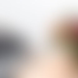 Exploring the Link Between Autoimmune Alopecia and Leaky Gut